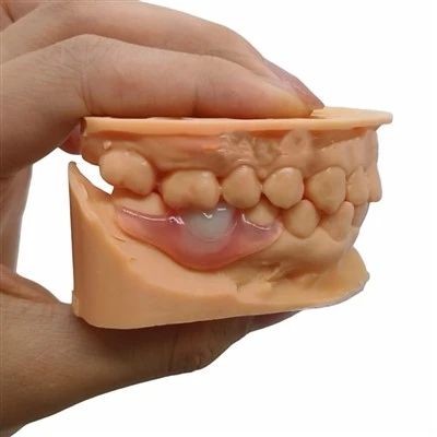 Протез Nesbit Valplast